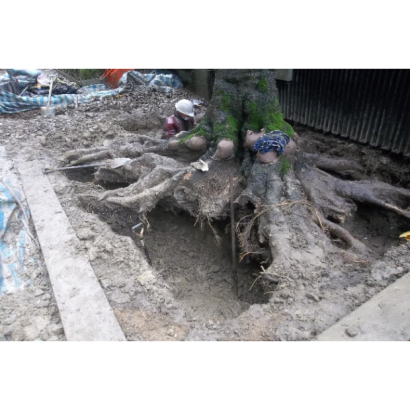 麗水松園朴樹外科手術